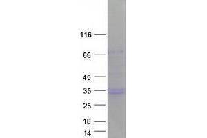 Validation with Western Blot
