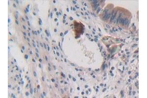 Detection of MCSF in Mouse Uterus Tissue using Polyclonal Antibody to Colony Stimulating Factor 1, Macrophage (MCSF)