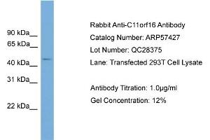 WB Suggested Anti-C11orf16  Antibody Titration: 0. (C11ORF16 anticorps  (Middle Region))