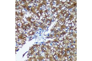 Immunohistochemistry of paraffin-embedded Rat liver using GRSF1 Rabbit pAb (ABIN7267319) at dilution of 1:100 (40x lens). (GRSF1 anticorps)