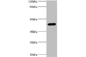 Western blot All lanes: Interleukin-1 receptor type 2 antibody at 3 μg/mL + Mouse kidney tissue Secondary Goat polyclonal to rabbit IgG at 1/10000 dilution Predicted band size: 46, 34 kDa Observed band size: 46 kDa