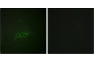 Immunofluorescence analysis of HeLa cells, using CD45 (Phospho-Ser1007) Antibody.