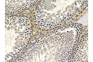 ABIN7097176 and ABIN7101244 at 1/100 staining rat testis tissue by IHC-P. (AP1S2 anticorps)