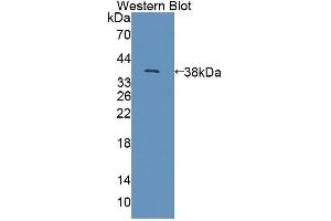 Western blot analysis of the recombinant protein. (NKp44/NCR2 anticorps  (AA 22-120))