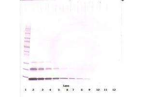 Image no. 1 for anti-Chemokine (C-C Motif) Ligand 16 (CCL16) antibody (ABIN465913) (CCL16 anticorps)