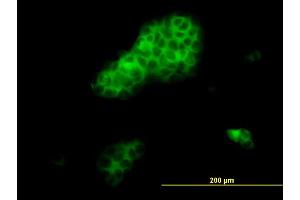 Immunofluorescence of monoclonal antibody to RHOA on A-431 cell. (RHOA anticorps  (AA 1-193))