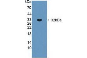 Western blot analysis of recombinant Human ABCC8. (ABCC8 anticorps  (AA 679-929))