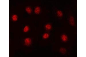 IF analysis of MAX using anti-MAX antibody (ABIN5692891).