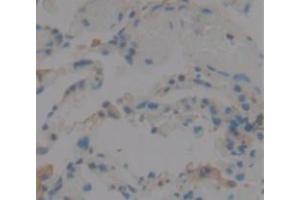 IHC-P analysis of Human Tissue, with DAB staining. (IL1F9 anticorps  (AA 1-162))