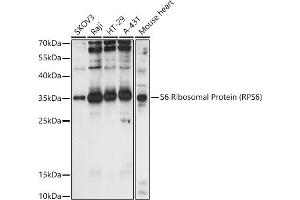Western blot analysis of extracts of various cell lines, using S6 Ribosomal Protein (RPS6) antibody (ABIN6133901, ABIN6147227, ABIN6147228 and ABIN6221687) at 1:1000 dilution.