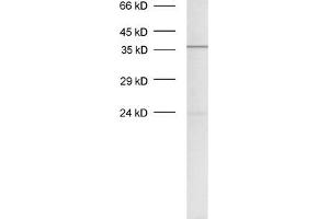 dilution: 1 : 500, sample: crude synaptosomal fraction of rat brain (P2) (Syntaxin 12/13 (AA 1-250), (Cytoplasmic Domain) anticorps)