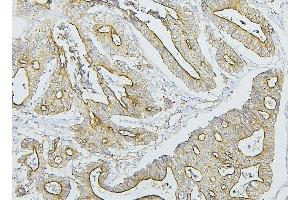 IHC analysis of NF2 using anti-NF2 antibody (ABIN7600115).