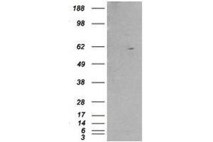 Image no. 1 for anti-Retinoid X Receptor, beta (RXRB) (Internal Region) antibody (ABIN374478) (Retinoid X Receptor beta anticorps  (Internal Region))