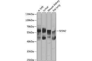 Western blot analysis of extracts of various cell lines, using SESN2 antibody (ABIN6128761, ABIN6147624, ABIN6147626 and ABIN6223421) at 1:1000 dilution. (Sestrin 2 anticorps  (AA 211-480))