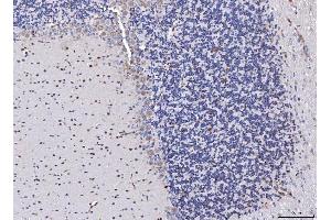 IHC analysis of FGF2 using anti-FGF2 antibody (ABIN7603215). (FGF2 anticorps  (N-Term))