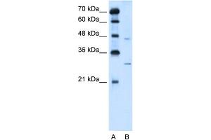 WB Suggested Anti-SLC36A3 Antibody Titration:  5.