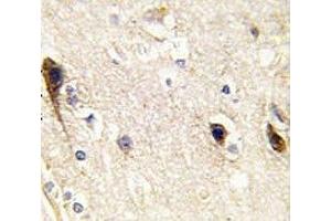 IHC analysis of FFPE human brain tissue stained with PIP5K1B antibody