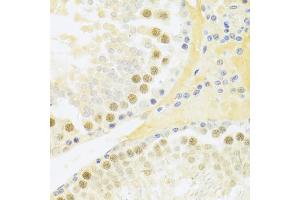 Immunohistochemistry of paraffin-embedded rat testis using RFC4 Antibody (ABIN5973195) at dilution of 1/100 (40x lens). (RFC4 anticorps)