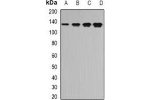 Western blot analysis of TPP2 expression in Jurkat (A), SW620 (B), mouse brain (C), mouse spleen (D) whole cell lysates.