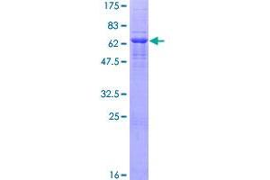 Image no. 1 for Neurotrimin (NTM) (AA 1-316) protein (GST tag) (ABIN1306888)