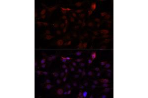 Immunofluorescence analysis of HUVEC cells using CD34 antibody. (CD34 anticorps)