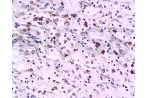 Formalin-fixed and paraffin embedded rat colon tissue labeled with Anti-PTAFR Polyclonal Antibody, Unconjugated  at 1:200 followed by conjugation to the secondary antibody and DAB staining