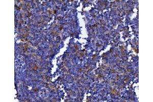 IHC analysis of MSF/SEPTIN9 using anti-MSF/SEPTIN9 antibody (ABIN7600104). (Septin 9 anticorps  (AA 15-282))