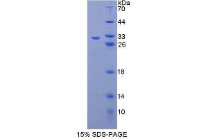 SDS-PAGE analysis of Human PGAM2 Protein.