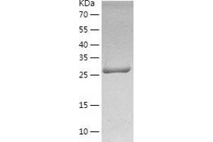 Western Blotting (WB) image for SLUG (AA 1-268) protein (His tag) (ABIN7125118) (SLUG Protein (AA 1-268) (His tag))