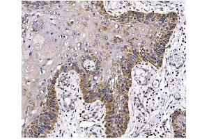 IHC analysis of PFKFB2 using anti-PFKFB2 antibody (ABIN7601627). (PFKFB2 anticorps  (AA 4-505))