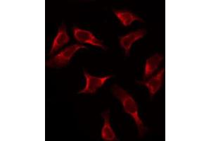 ABIN6272417 staining HeLa by IF/ICC. (RPS2 anticorps  (C-Term))