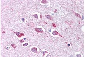 Anti-TLL2 antibody  ABIN1049410 IHC staining of human brain, neurons and glia.
