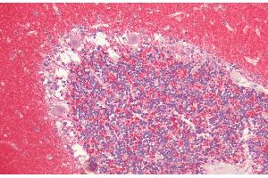 Immunohistochemistry analysis using Rabbit Anti-Alpha Synuclein Polyclonal Antibody (ABIN6698745). (SNCA anticorps  (HRP))