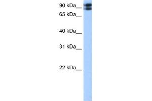 WB Suggested Anti-TMEM24 Antibody Titration:  0. (C2CD2L anticorps  (C-Term))
