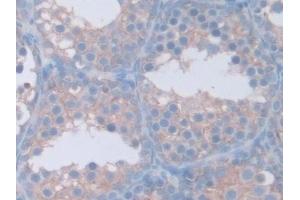 Detection of GAMT in Mouse Testis Tissue using Polyclonal Antibody to Guanidinoacetate-N-Methyltransferase (GAMT)