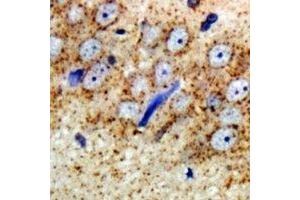 Immunohistochemical analysis of ARFGAP1 staining in rat brain  formalin fixed paraffin embedded tissue section. (ARFGAP1 anticorps)