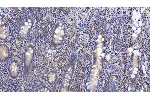 Detection of VF in Human Small intestine Tissue using Monoclonal Antibody to Visfatin (VF) (NAMPT anticorps  (AA 1-491))