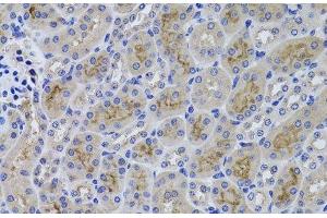 Immunohistochemistry of paraffin-embedded Mouse kidney using GGT1 Polyclonal Antibody at dilution of 1:100 (40x lens). (GGT1 anticorps)