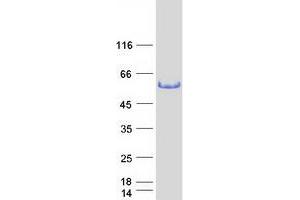 Trk-Fused Gene (TFG) (Transcript Variant 2) protein (Myc-DYKDDDDK Tag)
