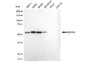 Western blotting analysis using NOVA1 antibody (ABIN7799578).
