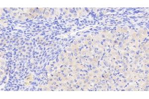 Detection of GKRP in Rat Ovary Tissue using Polyclonal Antibody to Glucokinase Regulatory Protein (GKRP)