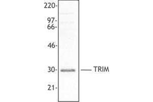 Western Blotting (WB) image for anti-T Cell Receptor Associated Transmembrane Adaptor 1 (TRAT1) (AA 29-186) antibody (ABIN2666376) (TRIM anticorps  (AA 29-186))