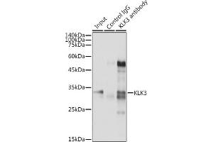 Immunoprecipitation analysis of 300 μg extracts of LNCaP cells using 3 μg KLK3 antibody (ABIN3022794, ABIN3022795, ABIN3022796 and ABIN6219231).