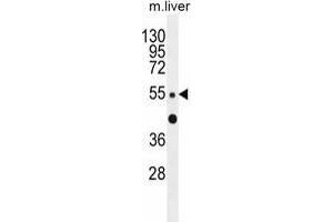 ZNF672 Antibody (C-term) western blot analysis in mouse liver tissue lysates (35 µg/lane). (ZNF672 anticorps  (C-Term))