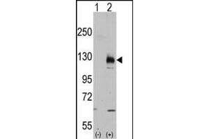 Western blot analysis of TR (arrow) using rabbit polyclonal TR Antibody (C-term ) (ABIN392821 and ABIN2842253).