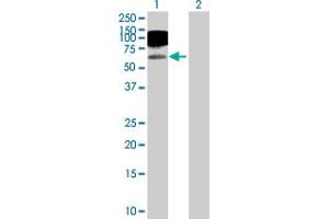Western Blot analysis of ICAM1 expression in transfected 293T cell line by ICAM1 MaxPab polyclonal antibody. (ICAM1 anticorps  (AA 1-532))