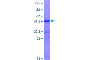 Image no. 1 for Distal-Less Homeobox 6 (DLX6) (AA 1-175) protein (GST tag) (ABIN1351704)