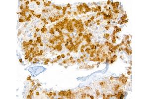 Immunohistochemistry (IHC) image for anti-Lymphocyte Antigen 6 Complex, Locus G (Ly6g) antibody (ABIN7448893) (Ly6g anticorps)