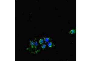 Immunofluorescent analysis of Hela cells using ABIN7148902 at dilution of 1:100 and Alexa Fluor 488-congugated AffiniPure Goat Anti-Rabbit IgG(H+L) (CDK7 anticorps  (AA 212-341))