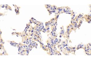 Detection of TLR5 in Human Lung Tissue using Polyclonal Antibody to Toll Like Receptor 5 (TLR5)